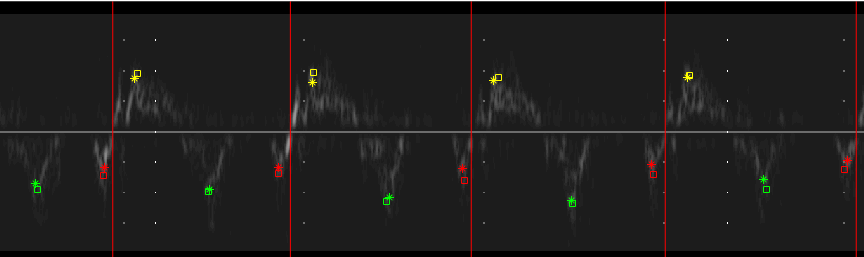 TDI example strip