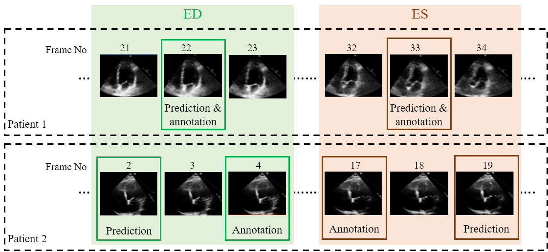 pacs examples